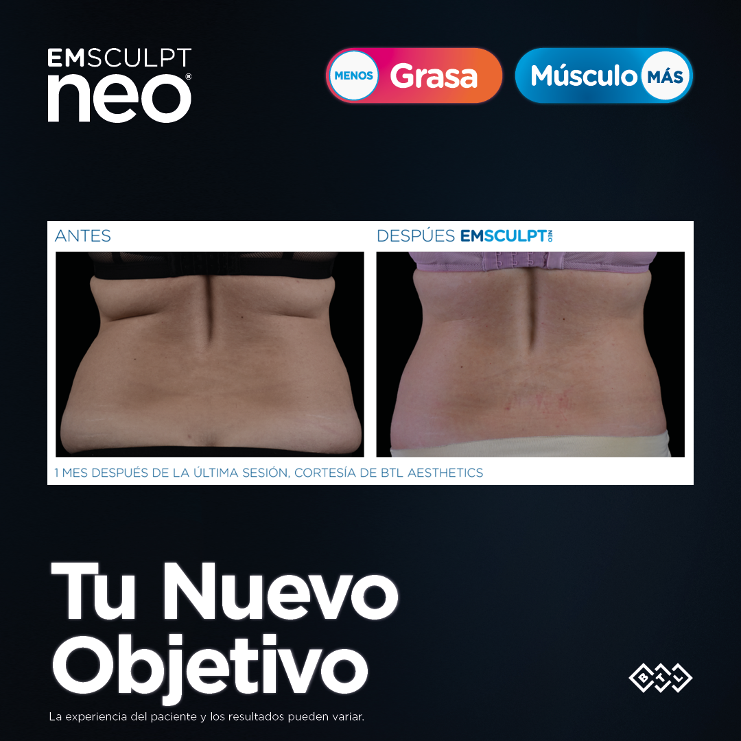 EMSCULPT NEO