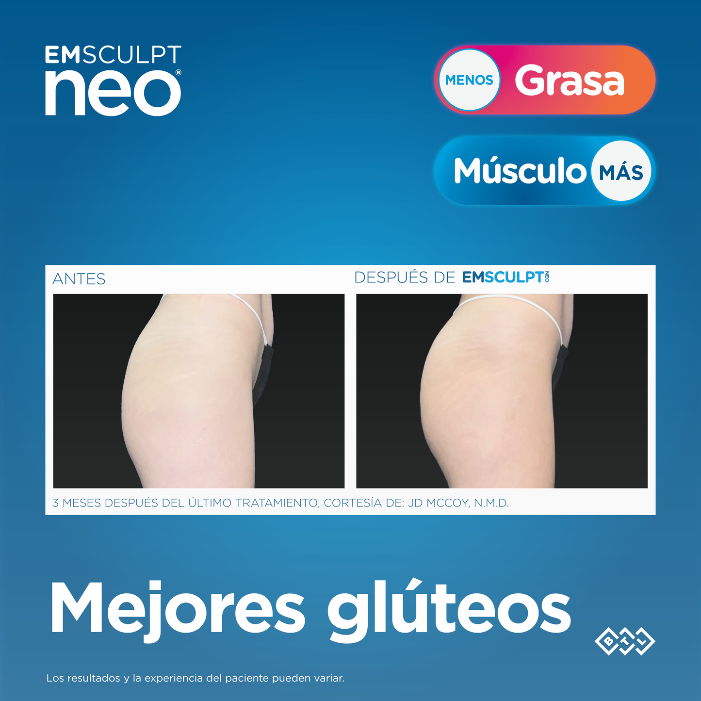 EMSCULPT NEO