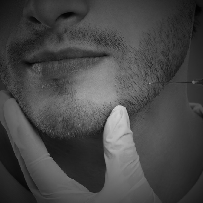 Contorno mandibular