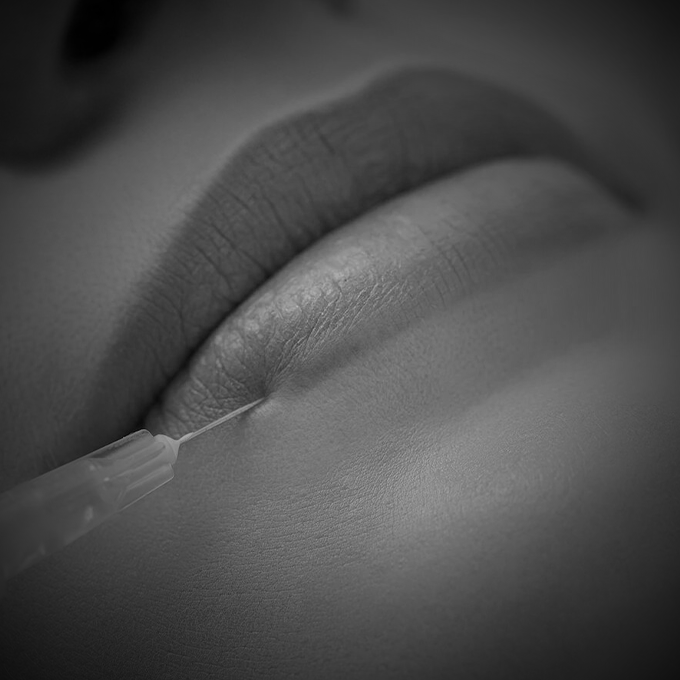 Labios