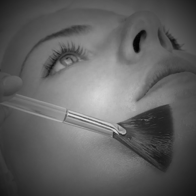 Peeling Químico